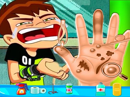 Spielen Ben10 Hand Doctor Spiel