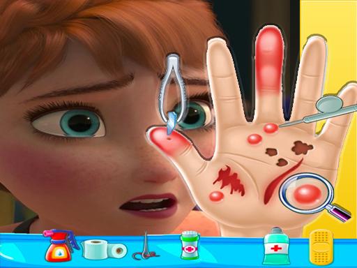 Spielen Anna Frozen Hand Doctor Spiel